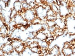 WT1 Antibody (WT1/3477R) - Azide and BSA Free, Novus Biologicals 100 &mu;g;